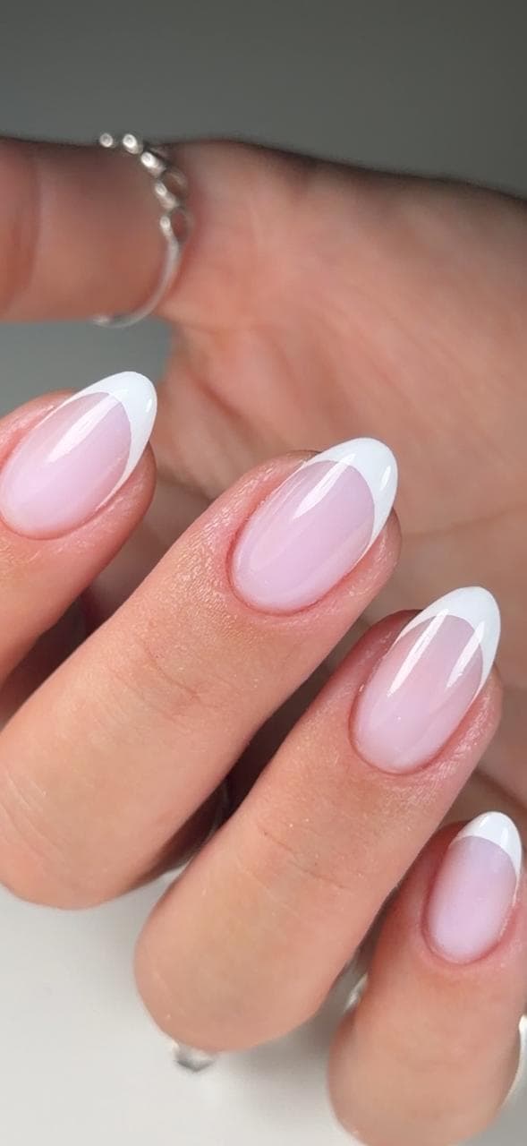 Francesa Sorriso em gel